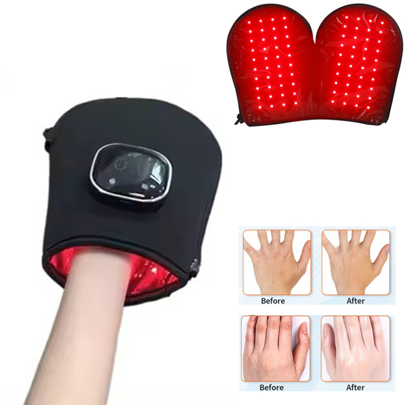 Red Light Therapy Device - อุปกรณ์บำบัดด้วยแสงสีแดงรุ่นใหม่สำหรับมือ ไฟ LED ใกล้รังสีอินฟราเรด บำรุงผิว ชาร์จผ่าน